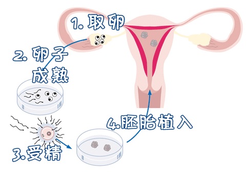 国内那里有借卵代孕